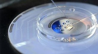 试管婴儿第三代技术优势，试管婴儿第三代成功率高达80%以上